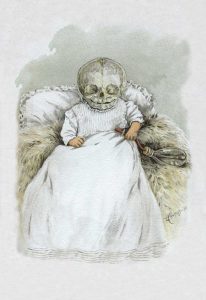 Death in Swaddling Clothing